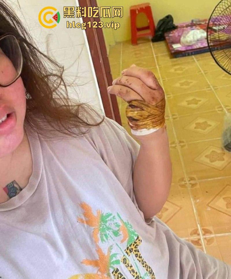 柬埔寨骗招诱国人入境 再要求家里500万赎人 剁手殴打暴力索钱视频流出 胆小慎入