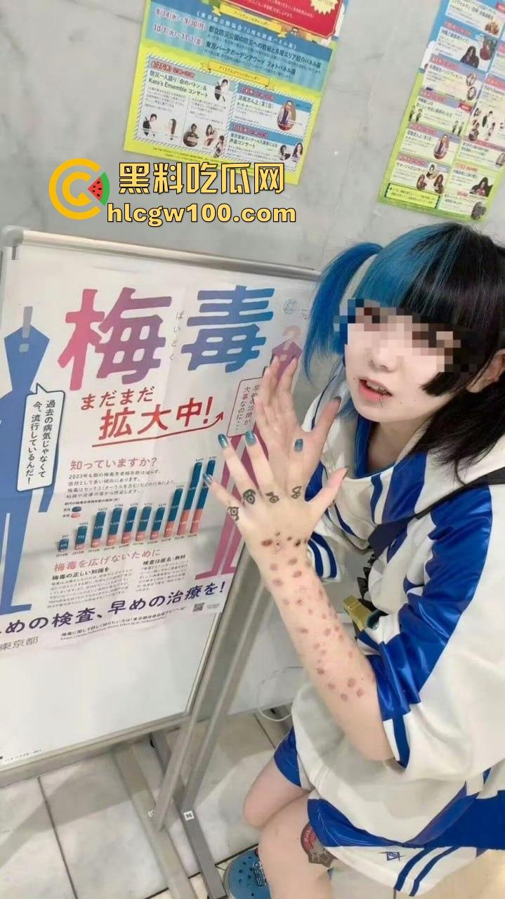 日本性病感染激增背后的文化畸形 性产业的泛滥让健康危机全面爆发 性病被当成时尚让性病成社会毒瘤!-8