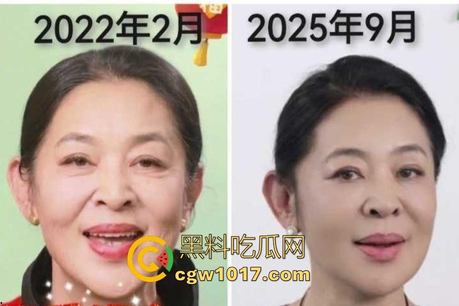 你见过心脏移植的明星吗?【李连杰】等众多大咖器官移植,换心换血黑科技年轻20岁,难道真有这种永生秘方?-4