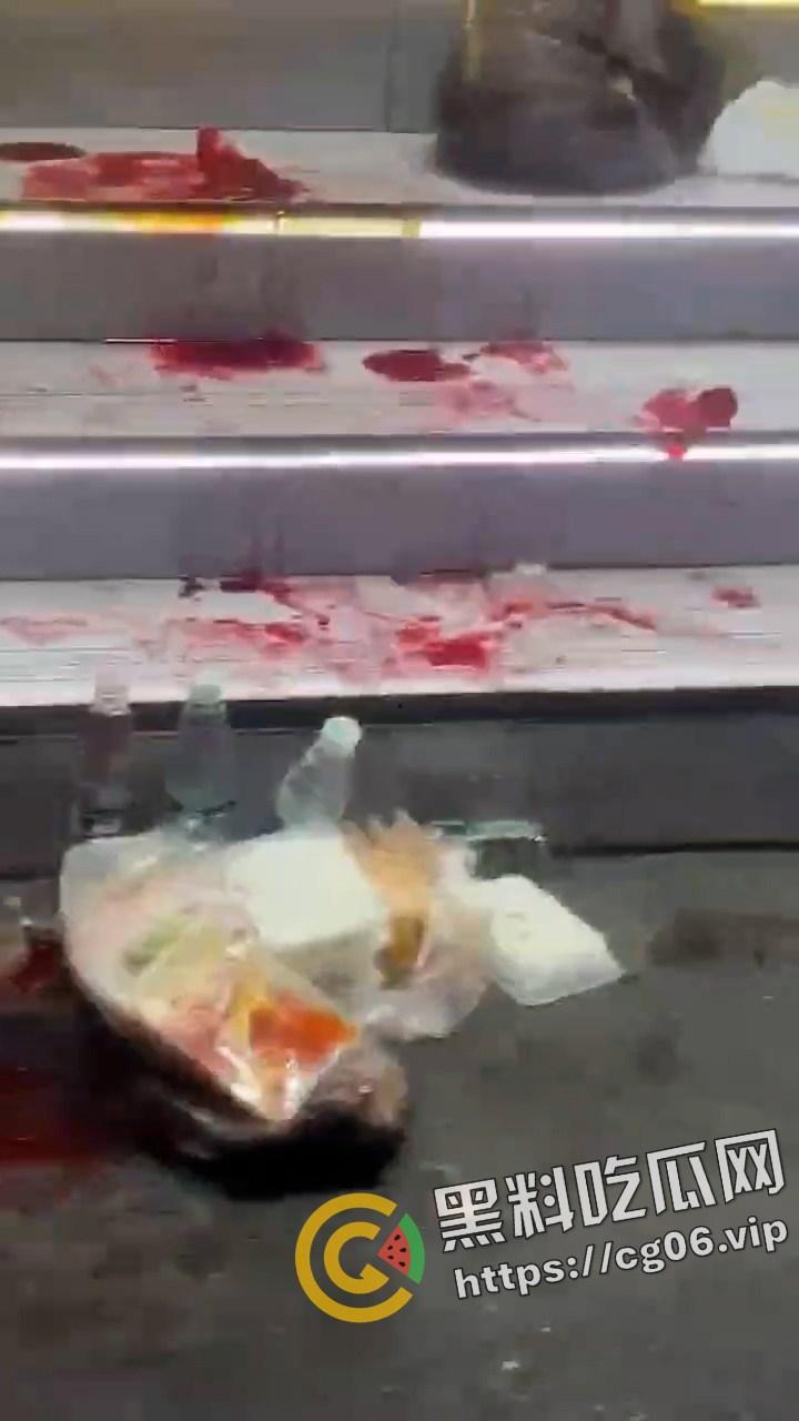 广州天河区斯维珈理发沙龙 顾客不满发型与理发师起冲突 被理发师扎爆眼球 现场画面曝光 过于血腥-6