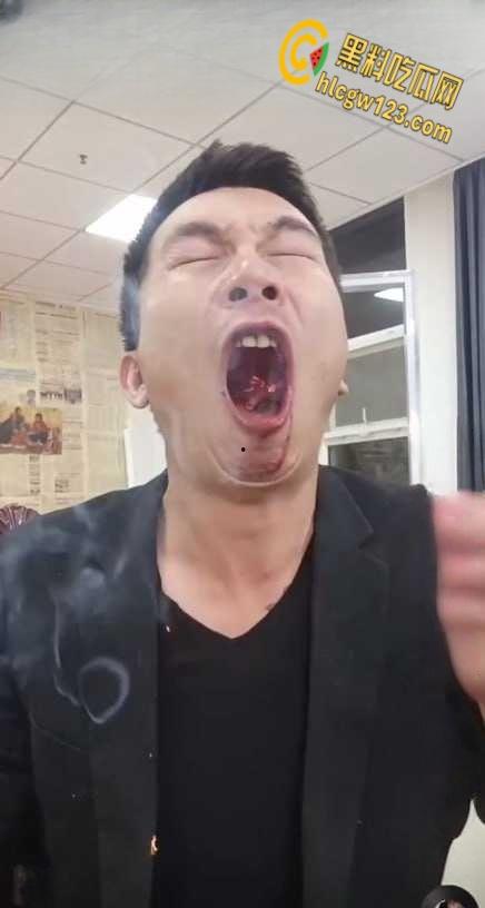 抖音狠人博流量 , 鞭炮嘴炸出血,脑残操作震惊全网 !-4