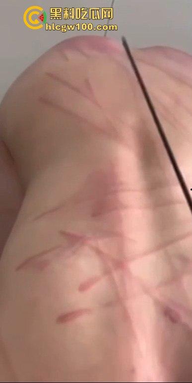 重口味推荐！山东滨州博兴三中学生妹【于翰然】金主SM调教视频流出，追求极致体验屁股都被给打烂流血了。-13