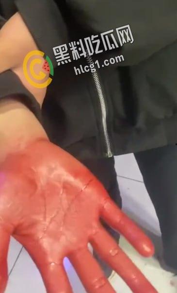 青海西宁 一女孩在酒店里遭多人暴打侮辱 扇耳光割头发 还逼迫女孩脱光全身衣服拍照!-6