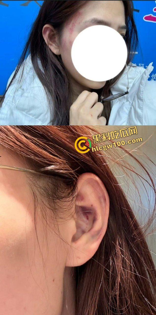 街球圈情侣大瓜!杭州街球手【程鑫凯】家暴女网红【鸡腿诺】多处打伤哭泣现场!独家开盒流出!-13