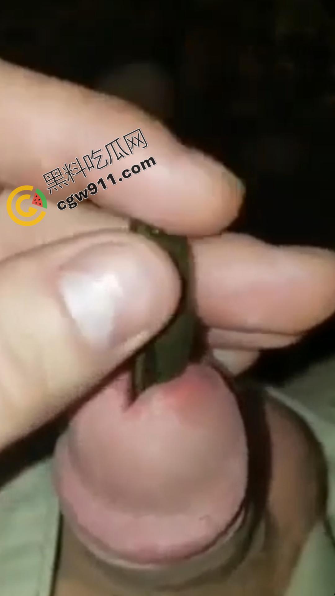 恐怖刺激!活蚂蟥钻入男子大屌的惊悚作死视频,观看者直呼恶心,视觉冲击骇人听闻-3